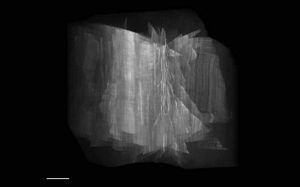 Peter Kner et al., Super-resolution video microscopy of live cells by structured illumination, Ausschnitt, 2009 © Macmillan Publishers Ltd: Nature Methods, 2009